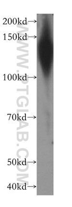 SLC12A4 Antibody in Western Blot (WB)