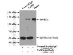 ValRS Antibody in Immunoprecipitation (IP)