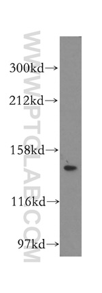 ValRS Antibody in Western Blot (WB)