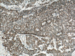 IDH2 Antibody in Immunohistochemistry (Paraffin) (IHC (P))