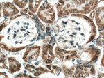 IDH2 Antibody in Immunohistochemistry (Paraffin) (IHC (P))