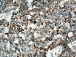 IDH2 Antibody in Immunohistochemistry (Paraffin) (IHC (P))