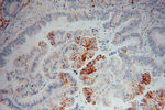 IDH2 Antibody in Immunohistochemistry (Paraffin) (IHC (P))