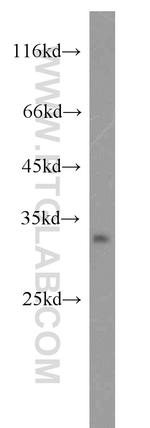 DNASE2 Antibody in Western Blot (WB)