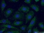 Piezo1 Antibody in Immunocytochemistry (ICC/IF)