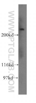 Piezo1 Antibody in Western Blot (WB)