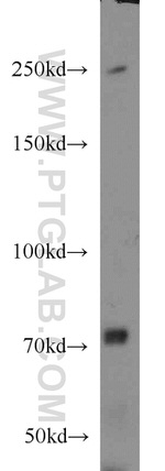 Piezo1 Antibody in Western Blot (WB)