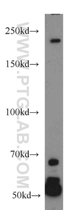 Piezo1 Antibody in Western Blot (WB)