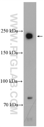 Piezo1 Antibody in Western Blot (WB)