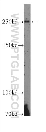 Piezo1 Antibody in Western Blot (WB)