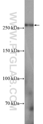 Piezo1 Antibody in Western Blot (WB)