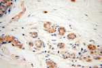 CAPZA2 Antibody in Immunohistochemistry (Paraffin) (IHC (P))