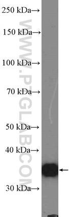 CAPZA2 Antibody in Western Blot (WB)