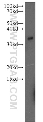 CAPZA2 Antibody in Western Blot (WB)