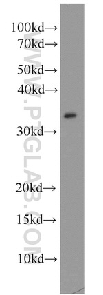 CAPZA2 Antibody in Western Blot (WB)