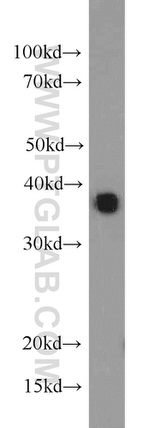 CAPZA2 Antibody in Western Blot (WB)