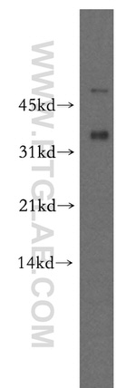 CAPZA2 Antibody in Western Blot (WB)