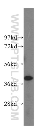 DYNC2LI1 Antibody in Western Blot (WB)