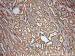 MAT2B Antibody in Immunohistochemistry (Paraffin) (IHC (P))