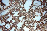 MAT2B Antibody in Immunohistochemistry (Paraffin) (IHC (P))