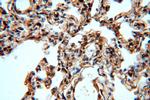 MAT2B Antibody in Immunohistochemistry (Paraffin) (IHC (P))