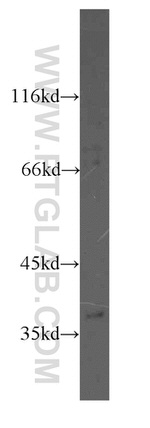 MAT2B Antibody in Western Blot (WB)