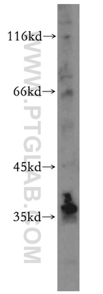 MAT2B Antibody in Western Blot (WB)