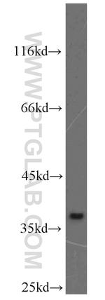 MAT2B Antibody in Western Blot (WB)