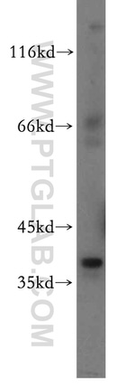 MAT2B Antibody in Western Blot (WB)