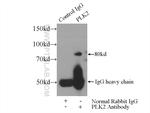 PLK2 Antibody in Immunoprecipitation (IP)