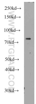 PLK2 Antibody in Western Blot (WB)