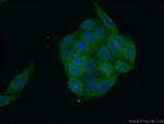 SH2D4A Antibody in Immunocytochemistry (ICC/IF)