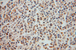 SEC24A Antibody in Immunohistochemistry (Paraffin) (IHC (P))