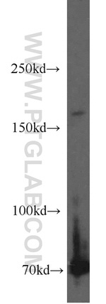 MBD5 Antibody in Western Blot (WB)