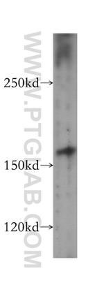 MBD5 Antibody in Western Blot (WB)