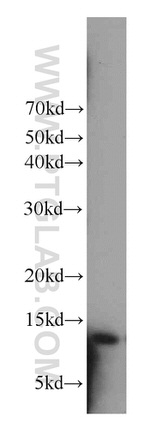 Cystatin A Antibody in Western Blot (WB)