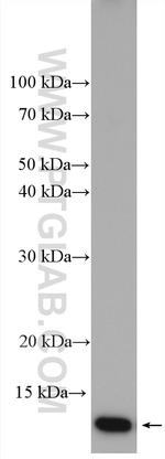 Cystatin A Antibody in Western Blot (WB)