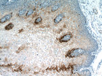 Elafin/Skalp Antibody in Immunohistochemistry (Paraffin) (IHC (P))