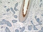 Elafin/Skalp Antibody in Immunohistochemistry (Paraffin) (IHC (P))