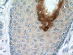 Elafin/Skalp Antibody in Immunohistochemistry (Paraffin) (IHC (P))