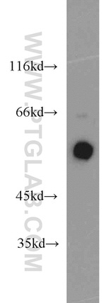 ERp57/ERp60 Antibody in Western Blot (WB)