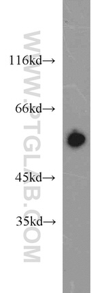 ERp57/ERp60 Antibody in Western Blot (WB)