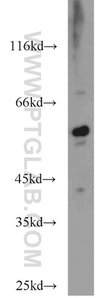 ERp57/ERp60 Antibody in Western Blot (WB)