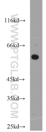 ERp57/ERp60 Antibody in Western Blot (WB)