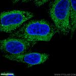 ERp57/ERp60 Antibody in Immunocytochemistry (ICC/IF)