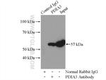 ERp57/ERp60 Antibody in Immunoprecipitation (IP)