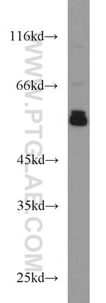 ERp57/ERp60 Antibody in Western Blot (WB)