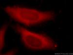 SDCCAG3 Antibody in Immunocytochemistry (ICC/IF)