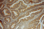 SDCCAG3 Antibody in Immunohistochemistry (Paraffin) (IHC (P))