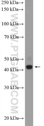 SDCCAG3 Antibody in Western Blot (WB)